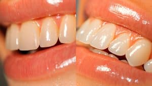 Orthodontiste dans le Pas-de-Calais (62)