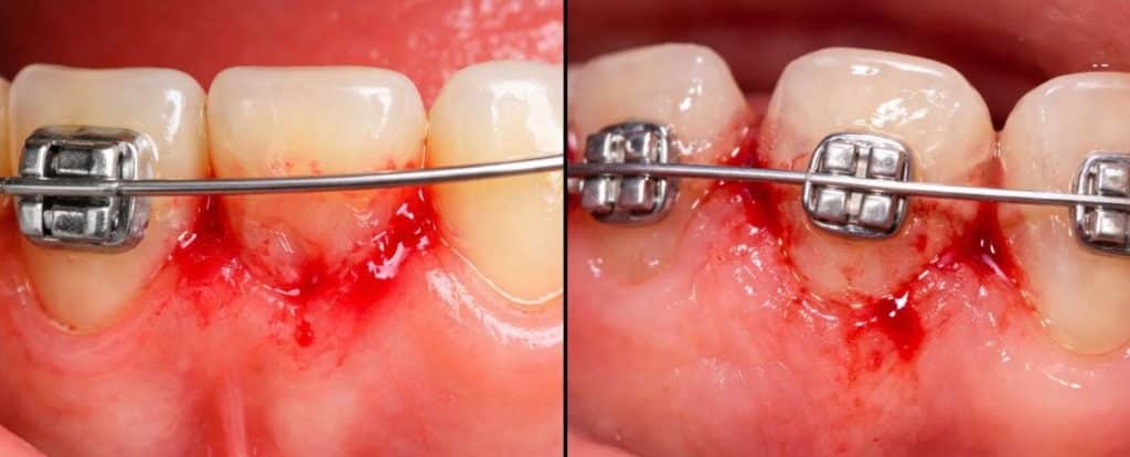 Blessure / choc : que faire ?