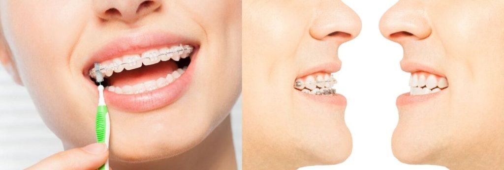 Hygiène bucco-dentaire irréprochable : un enjeu majeur