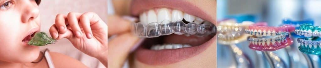 Présentation des options de traitement