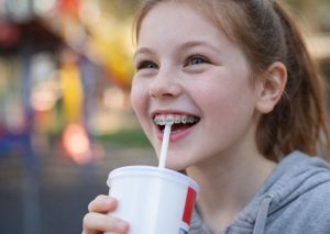 Boissons pour appareil dentaire : les conseils du Dr Maryse Dincq